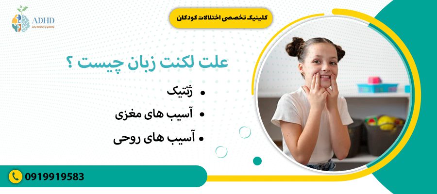 علت لکنت زبان چیست ؟